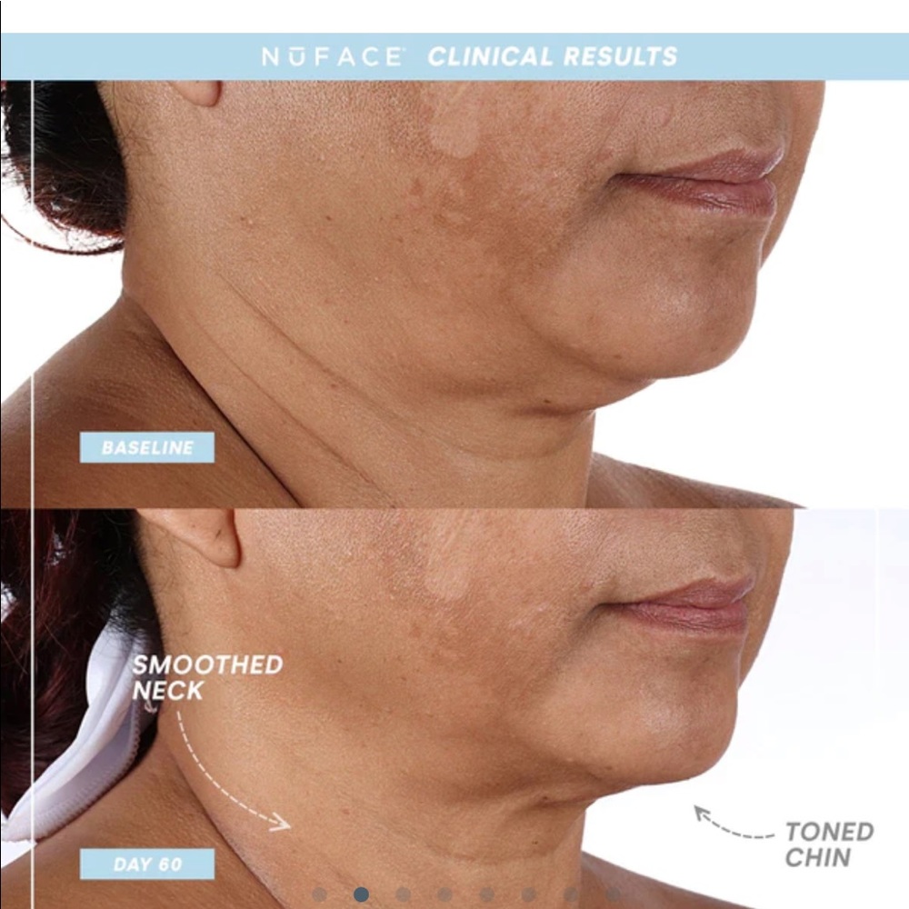 Nuface Mini Plus + - Picture 3 of 6